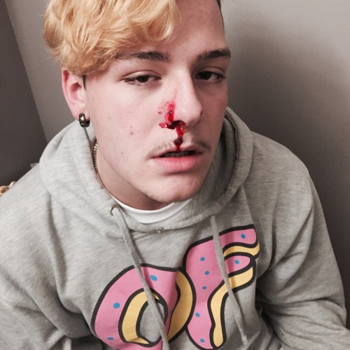 hpdog: I pierced my brothers nose