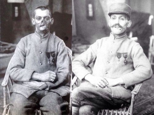 A disfigured French veteran of the First World War demonstrates a face mask designed to disguise his