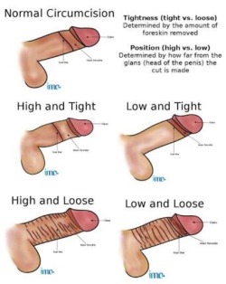 What style circumcision is yours? Or do you