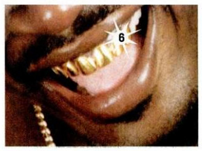 GUESS THE GRILLZ Answer here.