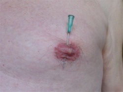 needle through nip