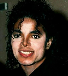 hvid Artifact trække always — Michael Jackson + showing vitiligo and no makeup.