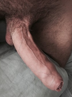 Foreskin Fever