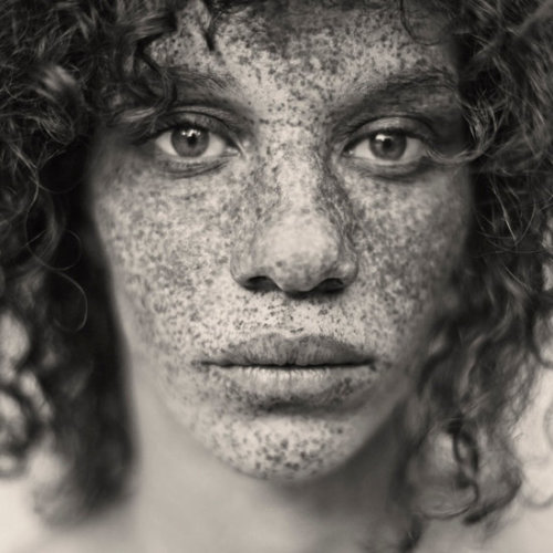 graphically-novel:I never see enough appreciation for freckles in magazines or movies, and being inc