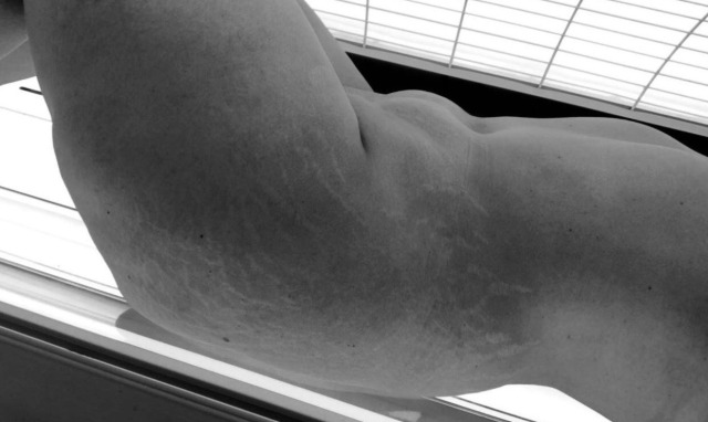 curvy-qos-deactivated20210926:Stretch marks