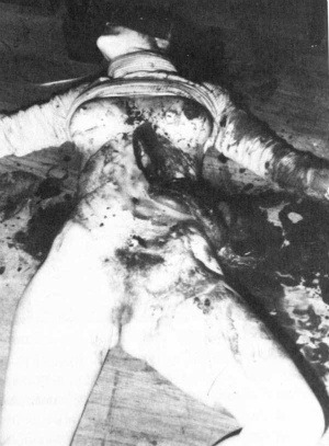 lairofthemacabre:  Victim of Richard Chase 