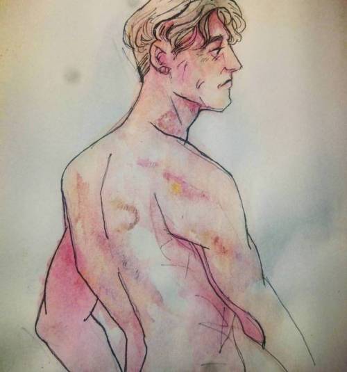 day1 Bruises I do not wish Oliver any discomfort but daymn look at him#olivermacey #originalcharacte