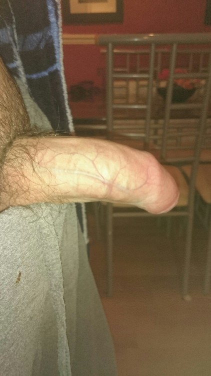 Needs a circumcision