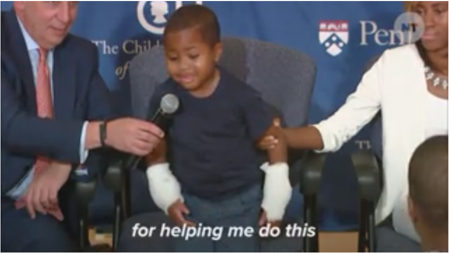 fuzzylocs:  yasboogie:  Owings Mills boy first recipient of double hand transplant