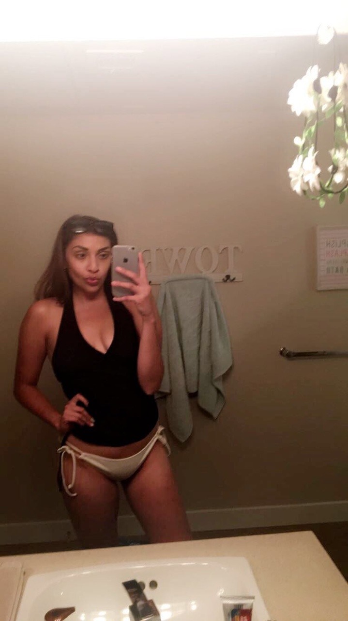 lovelyscars:  Ya girl 🙃😄