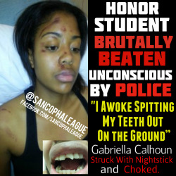 chariserenee:  thisiseverydayracism:  sancophaleague:  Just last month June 29th 2013, Gabriella Calhoun would be beaten unconscious by police. Gabby is an honor student at Wiley College. She finished high school a year early and went to college a year
