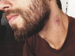 pokec0re:  hickeys are hot