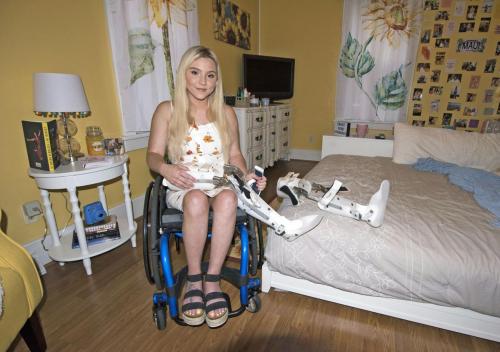 jackcast2021: Blonde para with her leg braces