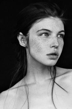 Freckled