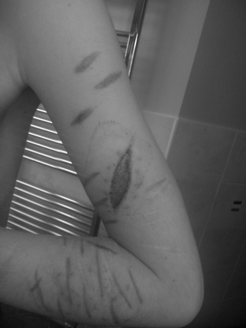my-dreamis-die:    