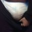 badbladder