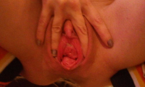 XXX What a monstrously huge pussy. The stem of photo