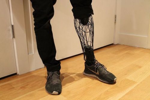 3D printed prosthesis.