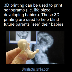 toastytofu:  sjturneronthecorner:  ultrafacts:  Source  More Ultrafacts  this is amazing…i’m just imagining a blind person who has the little print out of the baby in their pocket and going up to their friends and saying hey do you wanna see the baby….