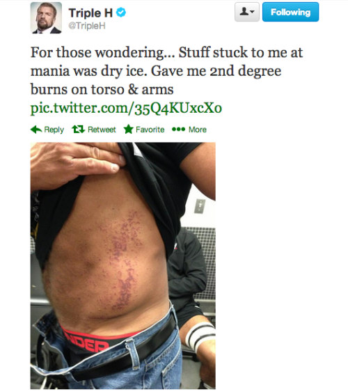 perrydaplatypus404:  Daaaaang…..  OUCH!! That had to burn like hell! But why are your jeans unbuttoned?! Is that Antonio Cesaro?! Oh I see what’s going on here! ;)