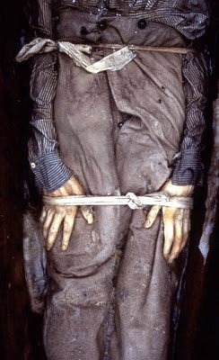Lower half of John Torrington of the Franklin expedition, buried in permafrost in 1846, Uncovered for forensic study in modern day. His clothing and skin are almost totally undamaged! Amazing after 250  yrs!