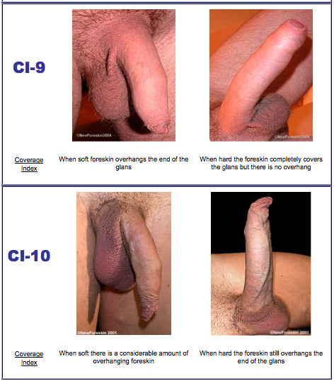 krsgor:  hakka2017:  thunderbromo:  Introducing the Foreskin Coverage Index (FCI)!  This index measures how much foreskin your penis has, from 1 (completely circumised) to 10 (foreskin overhang, even when soft). Which CI is YOUR penis? 😀  I think