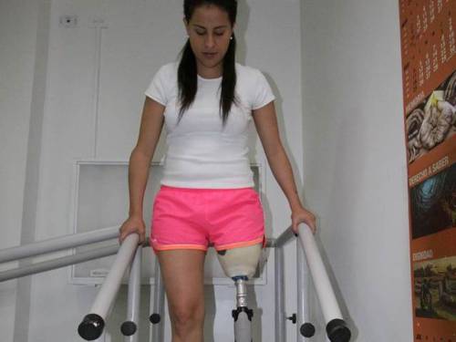  Yady Fernández Columbian soccer player who lost her left leg.