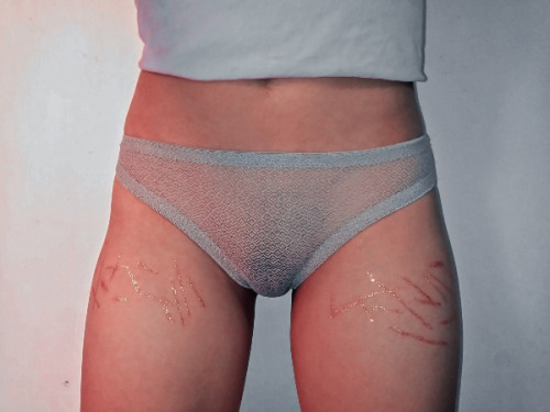 Can You Give Me Some Tattoo Ideas Please? To Hide The Scars