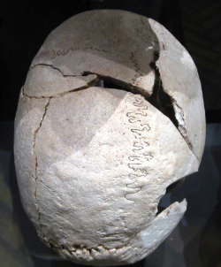 emt-monster:  valdanderthal:  emt-monster:  Fatal head injuries from the middle ages The bones are from around the 1200’s and were found at an abbey here. Top picture: Male, 25-35 years. Four lesions, at least one of them fatal: 1) Large fatal penetrating