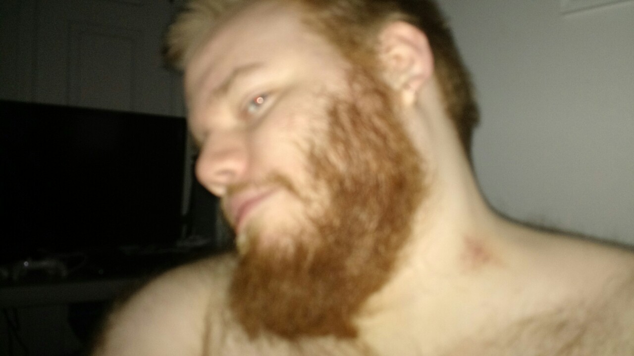 arcticferedir:  Sometimes hickies can just be a sign of a good night. Didn’t know