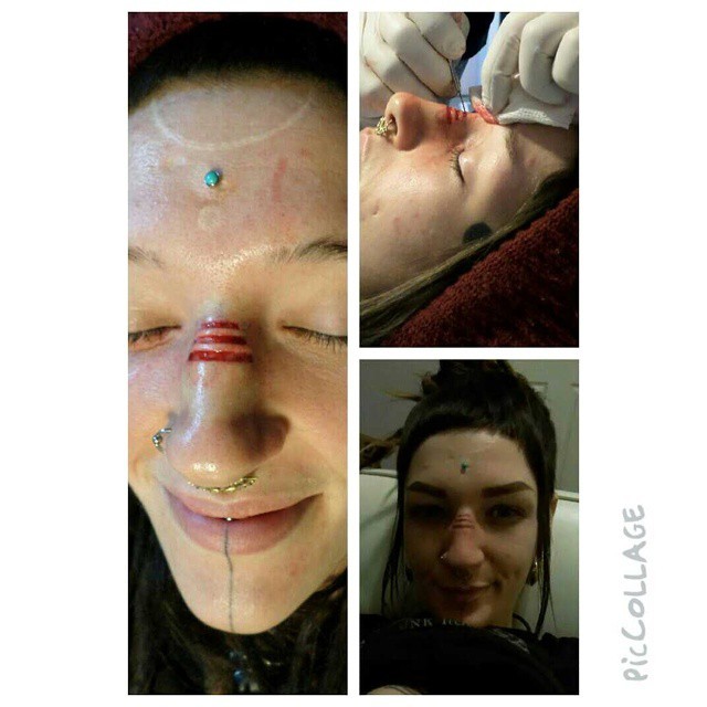 abcdhiv:So this happened…  Wow, beautiful. Can&rsquo;t wait to see it healed.