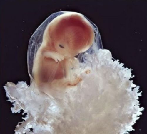 XXX scienceyoucanlove:  From: “A Child Is photo