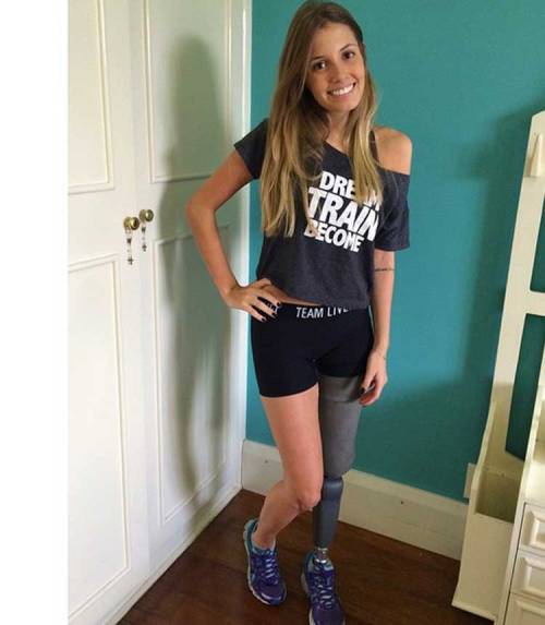 Paola Antonini. Now (on prosthetic leg, bandaged stump) and before accident (on both legs)