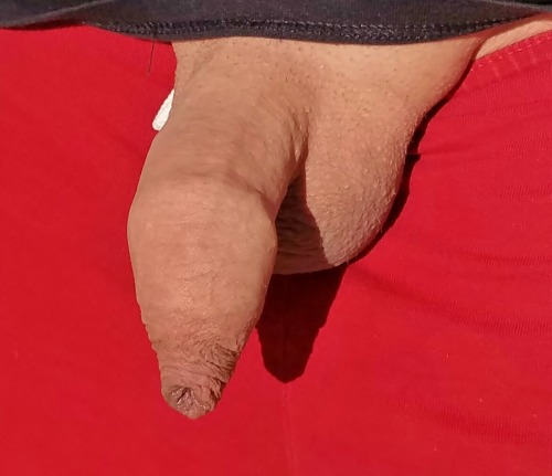 This is why we circumcise