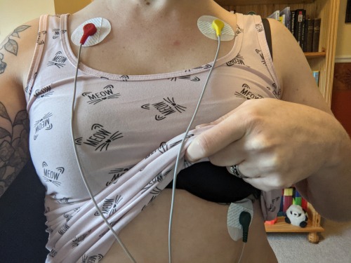 Wired up and ready for my exam, doctor. My heart is beating a little fast today…