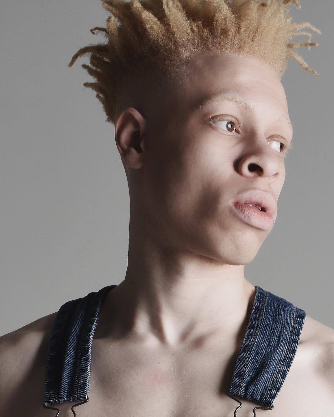 Albinos Model Tumblr Posts Tumbral Com