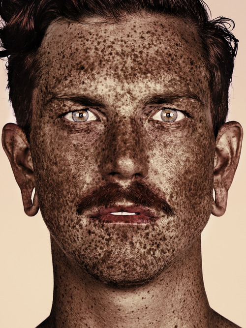 burnagain:  soldsoulglenx:  Amazing Freckles Portrait Series by MR ELBANK.  I love freckles!! 