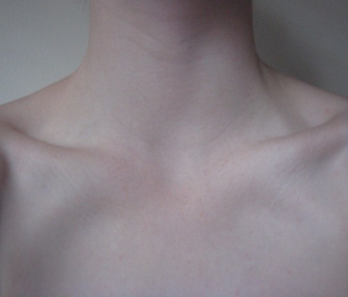 pale-skinned-youth:  c’mon skinny love, what happened here? on We Heart It - http://weheartit.com/entry/48681459/via/pale_skin