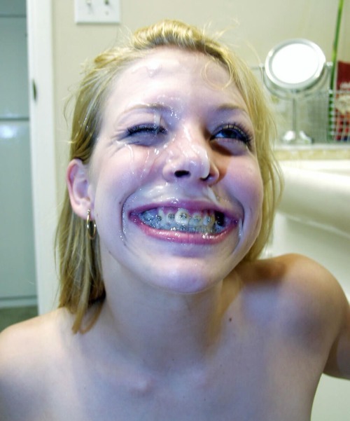 braces-fetish:  Incredible braces covered in cum… see more live on webcam www.afreecamsecret.com