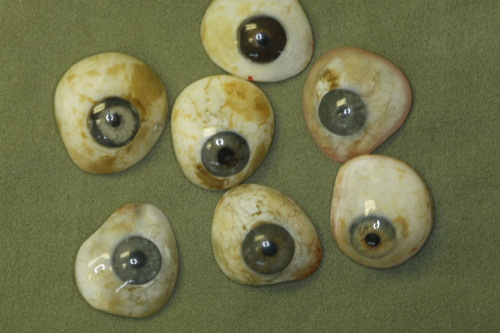 Artificial Eyes 1: These are hand painted eyes that an ocularist office made for ONE patient over he