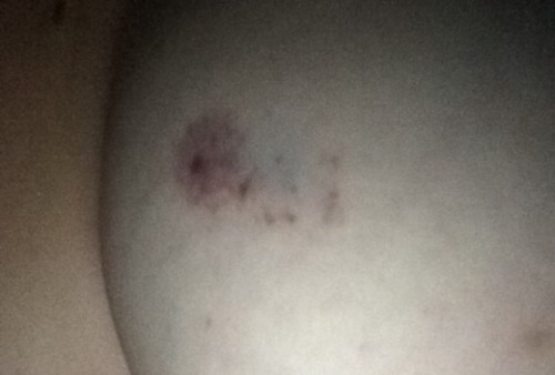 Love when daddy leaves marks. It’s gone now though 