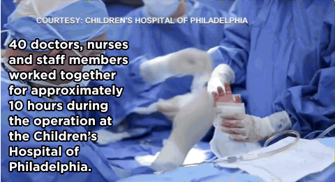 huffingtonpost:  WATCH: Boy, 8, Is First Child Ever To Receive Double Hand Transplant“Never