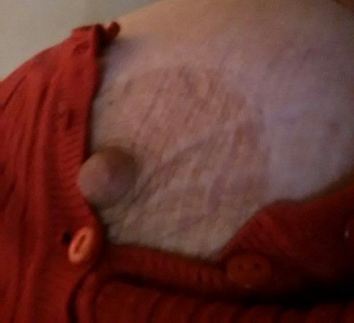 wickedlywenchy:   Its a bit nippy this morning;-) 