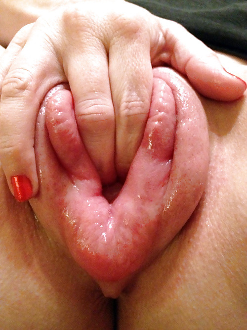 pussymodsgalore  Photoset showing a variety of vacuum pumped and swollen pussies. The more they swell up, the more inviting they look! 