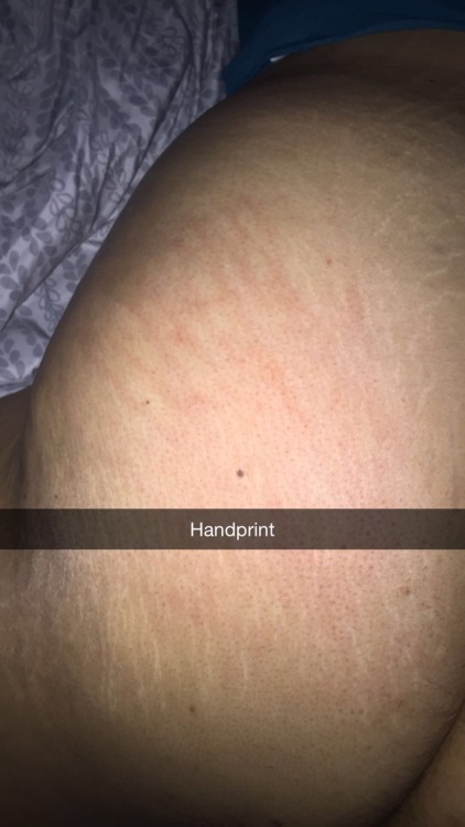 seriously-kinky-couple:  Fun from last night. D was cuffed and fucked hard  Gotta luv the handprint…..