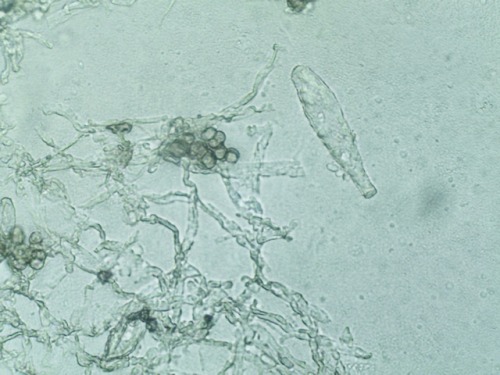 Powdery mildew fungi (Phyllactinia fraxini) on ash (Fraxinus excelsior).