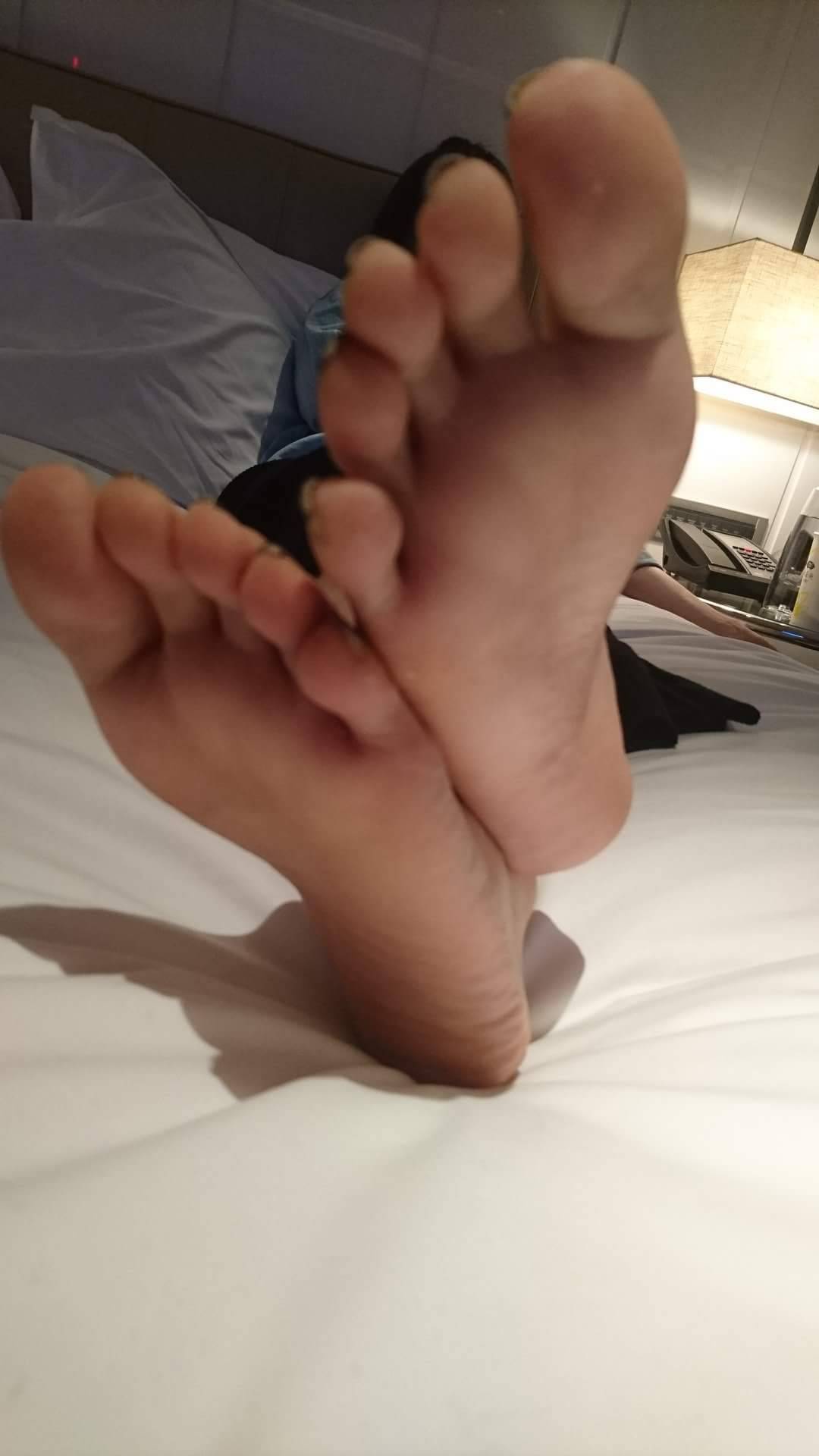 香港腳趾迷