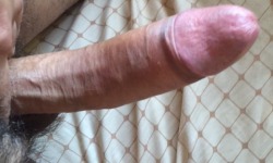 Long Foreskin