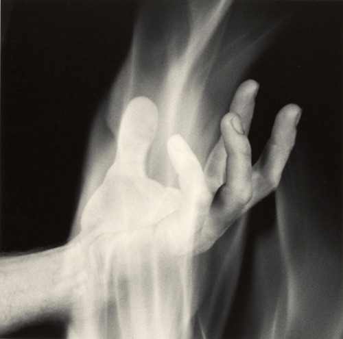 joeinct:Hand in Fire, Photo by Robert Mapplethorpe,