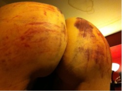 bdsm-whore:  slut-slave-trainer:  Very well beaten!!  I want my ass to look like that.